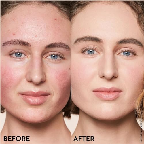 M. Asam Magic Finish Porcelain Teint Make-Up Mousse (1.01 Fl Oz) – 4in1 Primer, Foundation, Concealer & Powder With Buildable Coverage, Hides Redness And Dark Spots, Vegan, For Very Light Skin Tones