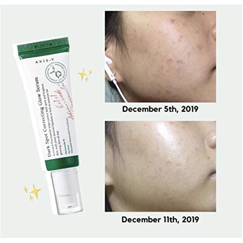 AXIS-Y Dark Spot Correcting Glow Serum 0.16 fl. oz. | Brightening Treatment, Anti-Aging, Acne Scars, Fine Lines, Hyperpigmentation, and Dark Circles