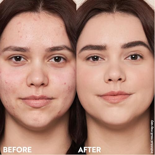 M. Asam Magic Finish Make-Up Mousse (1.01 Fl Oz) – 4in1 Primer, Foundation, Concealer & Powder With Buildable Coverage, Hides Redness And Dark Spots, Vegan, For Light To Medium Skin Tones
