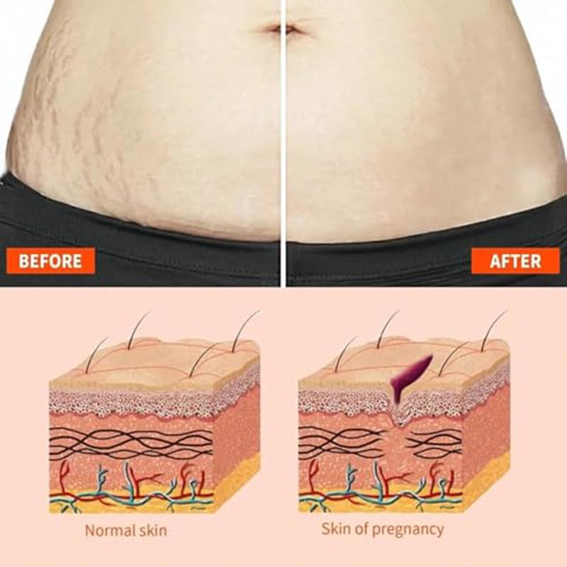 2 PCS Natrcollor Collagen Boosting Skin Gel, Moisturizes Skin, Reduces Stretch Marks & Scars, Improves Skin Tone