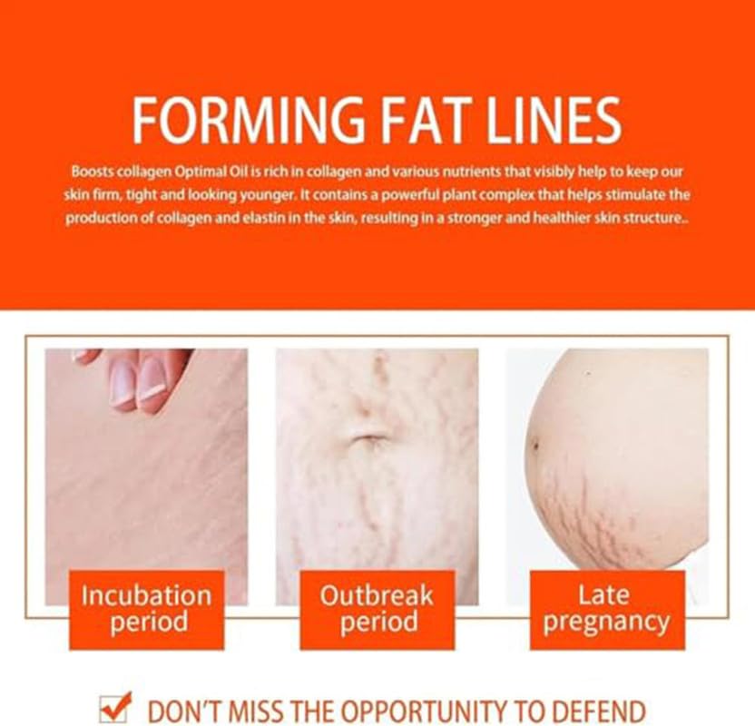 2 PCS Natrcollor Collagen Boosting Skin Gel, Moisturizes Skin, Reduces Stretch Marks & Scars, Improves Skin Tone
