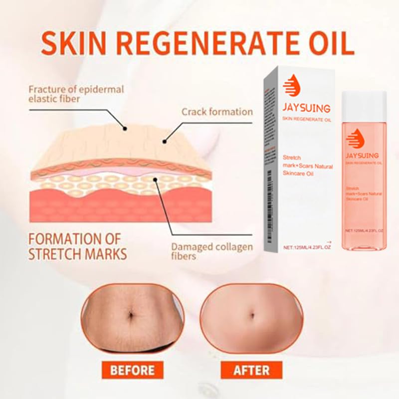 2 PCS Natrcollor Collagen Boosting Skin Gel, Moisturizes Skin, Reduces Stretch Marks & Scars, Improves Skin Tone