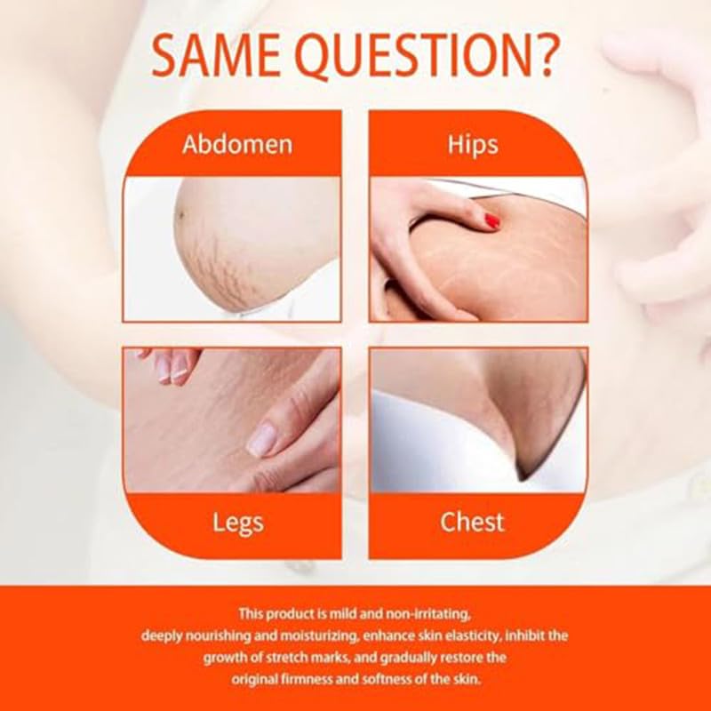 2 PCS Natrcollor Collagen Boosting Skin Gel, Moisturizes Skin, Reduces Stretch Marks & Scars, Improves Skin Tone