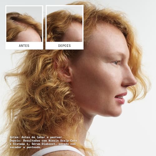 Nioxin Scalp + Hair Thickening System 1 Kit - Hair Thickening System for Natural Hair with Light Thinning - Shampoo, Conditioner & Scalp Treatment (150+150+50ml)