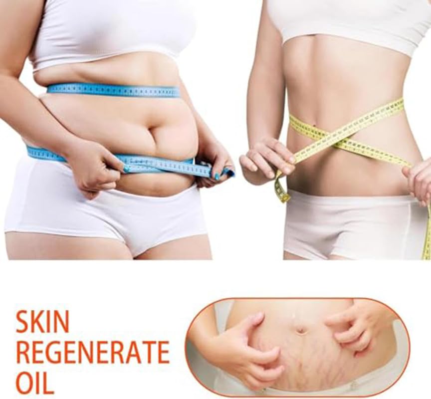 2 PCS Natrcollor Collagen Boosting Skin Gel, Moisturizes Skin, Reduces Stretch Marks & Scars, Improves Skin Tone