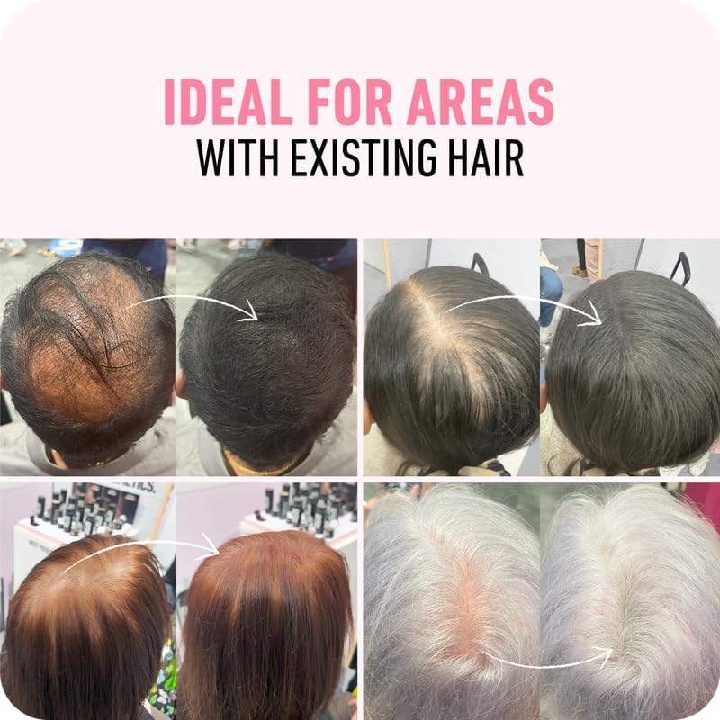 BOLDIFY Hair Fibres (28g) - Fill In Thinning and Fine Hair for an Instantly Fuller, Thicker Look - 14 Shades for Women and Men - Light Brown