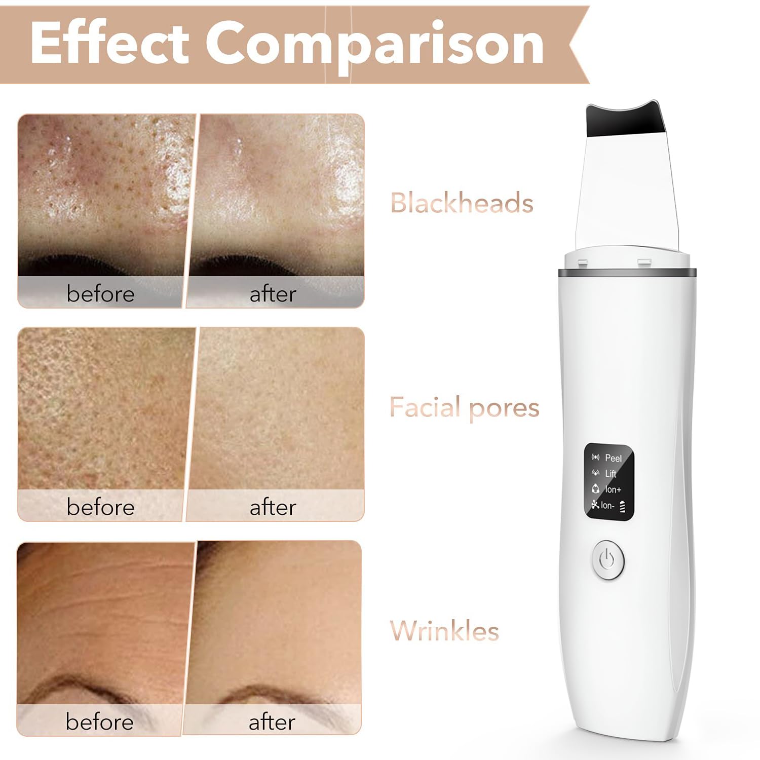 Face Scrubber Ultrasonic Skin Scrubber Blackhead Remover Tool Pore Remover Facial Skin Scrubber Electric for Deep Cleansing 4 Modes Blackhead Remover Rechargeable Include 2 Silicone Covers