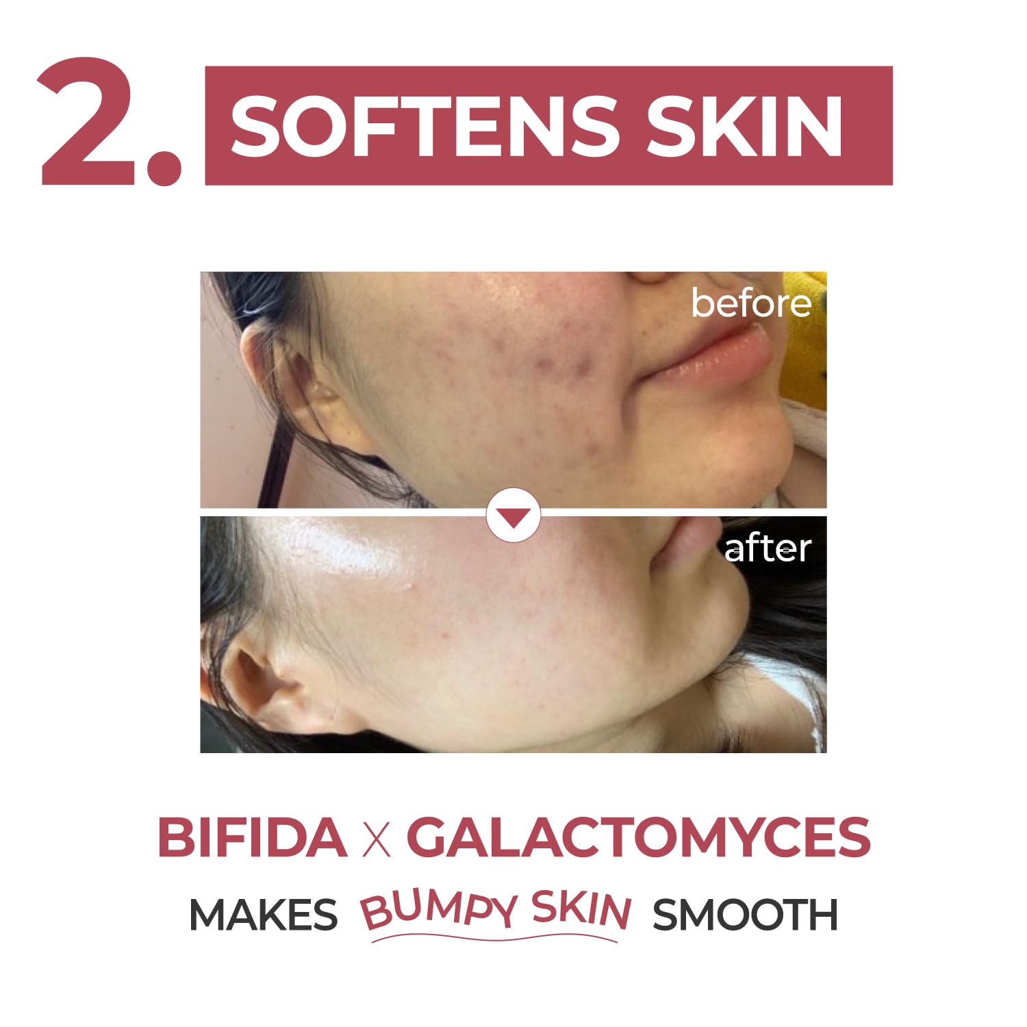 numbuzin No.3 Serum | Skin Softening Serum | Pores, Textured, Bumpy, Rough to Glass Skin | Bifida, Galactomyces, Niacinamide, Adenosine, Panthenol | 1.69 fl. oz.