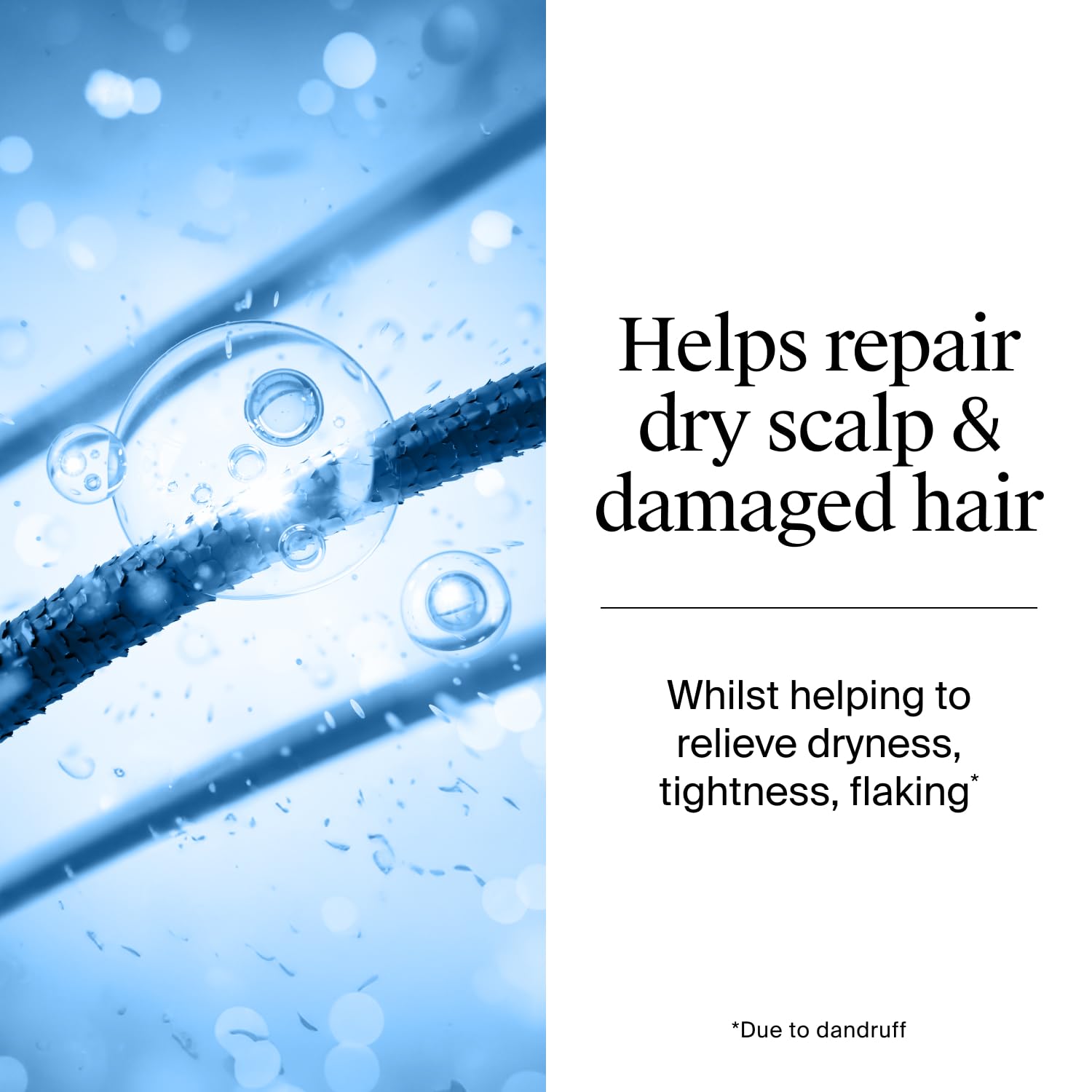 Neutrogena T/Gel Anti-Dandruff Shampoo for Dry Hair, 250 ml