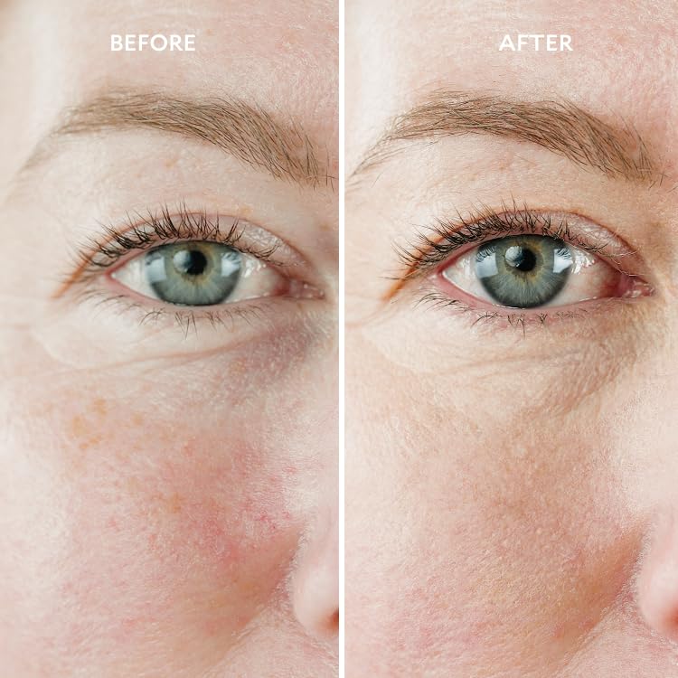 Gatineau - Miracle Eye Contour Cream, Conceal Dark Circles, Hydrating with Hyaluronic Acid & Vitamin E (11ml x 2)