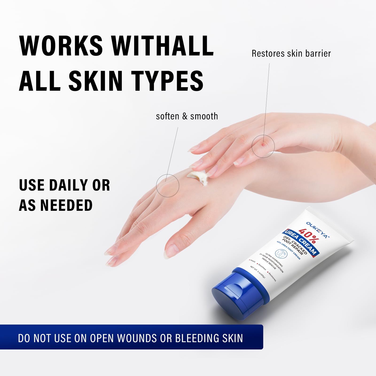 OUKEYA Urea Cream 40 Percent, Urea Foot & Hand Cream for Cracked Heels and Dry Skin, Urea Lotion for Deep Moisturizing, Callus Remover Nourishes Soften, Maximum Strength, Easy to Carry, 85g