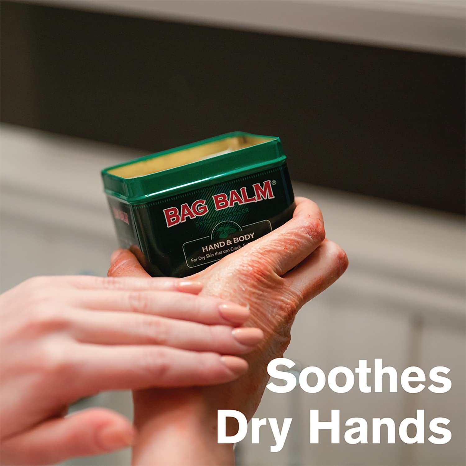 Bag Balm Vermont's Original for Dry Chapped Skin Conditions 8 Ounce Tin
