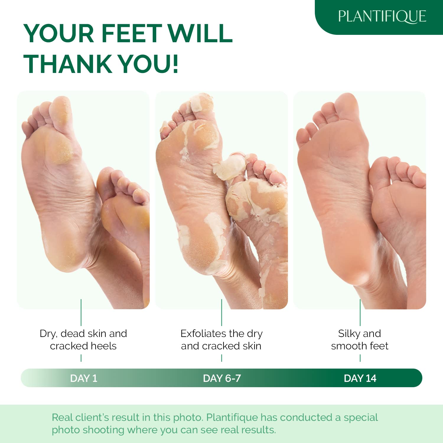 Plantifique Foot Peel Mask – 2 Pairs Exfoliating & Dermatologically Tested Foot Treatment, Removes Dead Skin & Repairs Heels for Soft Feet – Aloe Vera Scent, Gift for Men