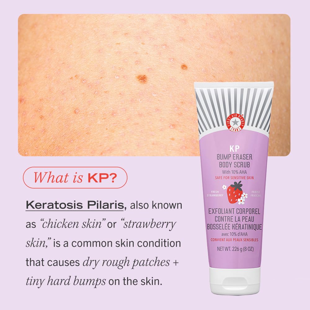 First Aid Beauty - KP Bump Eraser Body Scrub with 10% AHA, Keratosis Pilaris Exfoliater with Glycolic and Lactic acids, Helps Reduce Chicken Skin Bumps, Safe for Sensitive Skin, Strawberry Scent, 226g