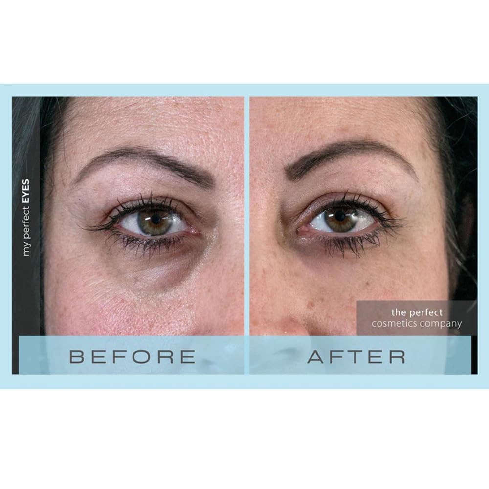 My Perfect Eyes 20ml, 200 Applications, Penny Lane, Instant Results, Clinically Proven, Anti-Ageing Serum UK Original Formula, Science-Backed Anti-Wrinkle Serum. As Seen on TV.