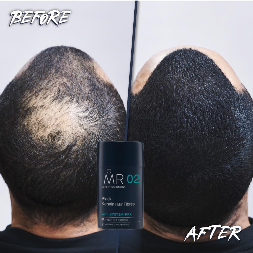 MR Medium Brown Hair Fibres (15g). Hair Loss Concealer with System-PPX, Thinning Hair Concealer for Bald Patch Cover Up, Hair Fibres Medium Brown, Hair Thickener for Men, Hair Texture Powder