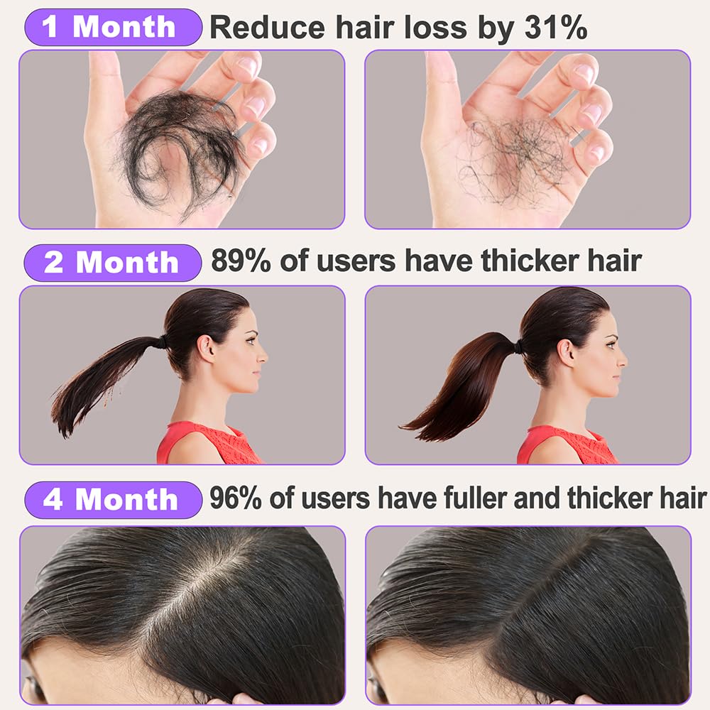 Sulphate Free Rosemary Oil Biotin Shampoo w/Scalp Massager & Argan Castor Oil Keratin Rice Water Conditioner Sets for Women's Hair Growth & Thickening - 2 in 1 Set