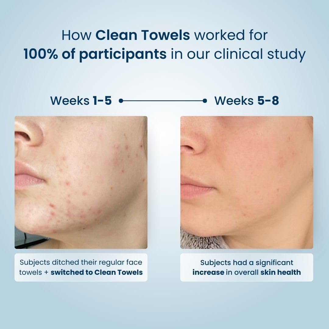 Clean Skin Club Clean Towels XL, Biodegradable Dermatologist Approved Face Towel, Disposable Makeup Remover Dry Wipes, Facial Wash Cloth for Sensitive Skin, 150 Count 3 Pack