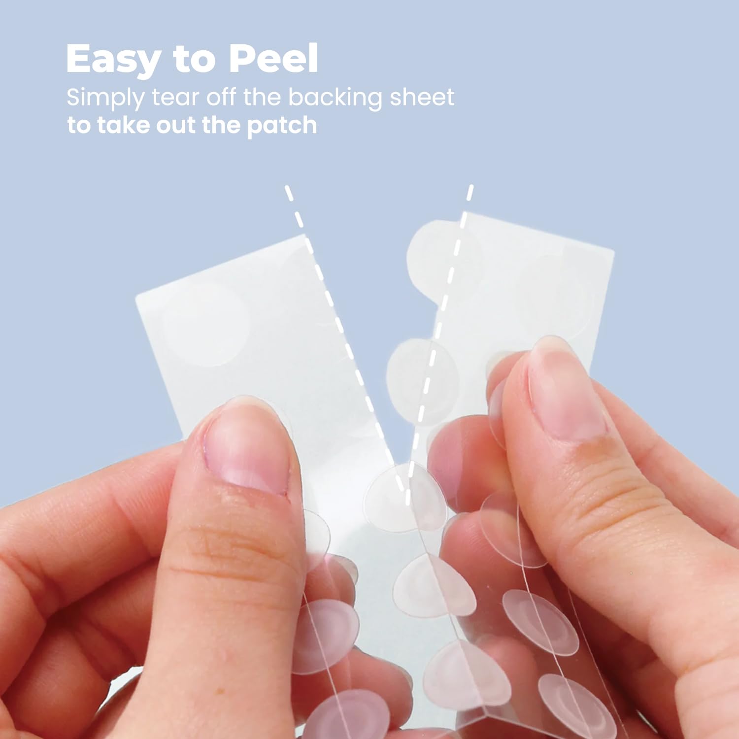 ROSELYNBOUTIQUE Pimple Patches 330 Dots - Hydrocolloid Spot Patches for Blemishes – Vegan & Cruelty-Free – Cosmetic Skincare Product for Face