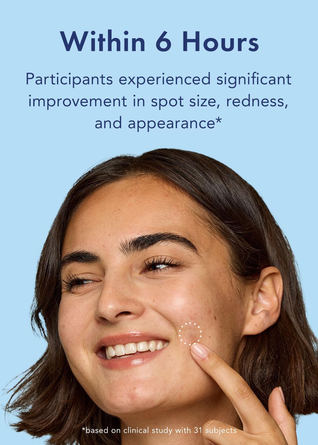 Rael Pimple Patches, Miracle Retinol Spot Cover - Korean Skincare, Hydrocolloid, Acne Spot Treatment Patch, Face Stickers, PM Advanced Treatment, Vegan & Cruelty Free (72 count)