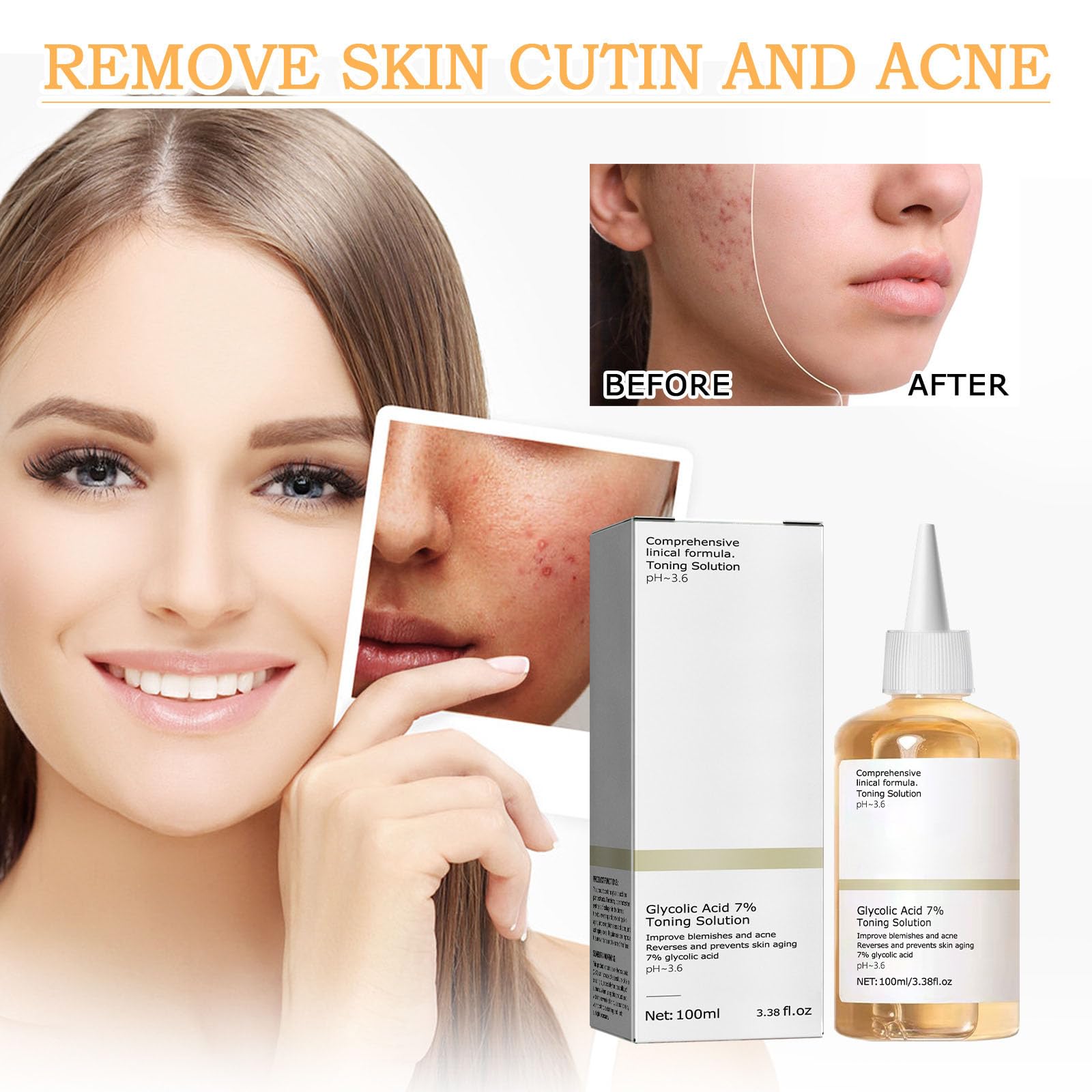 Glycolic Acid Toner, Glycolic Acid 7% Resurfacing Exfoliating Solution for Blemishes and Acne, Toner Suitable for Combination and Oily Skin, Pore Treatment (100ml) 2Pcs