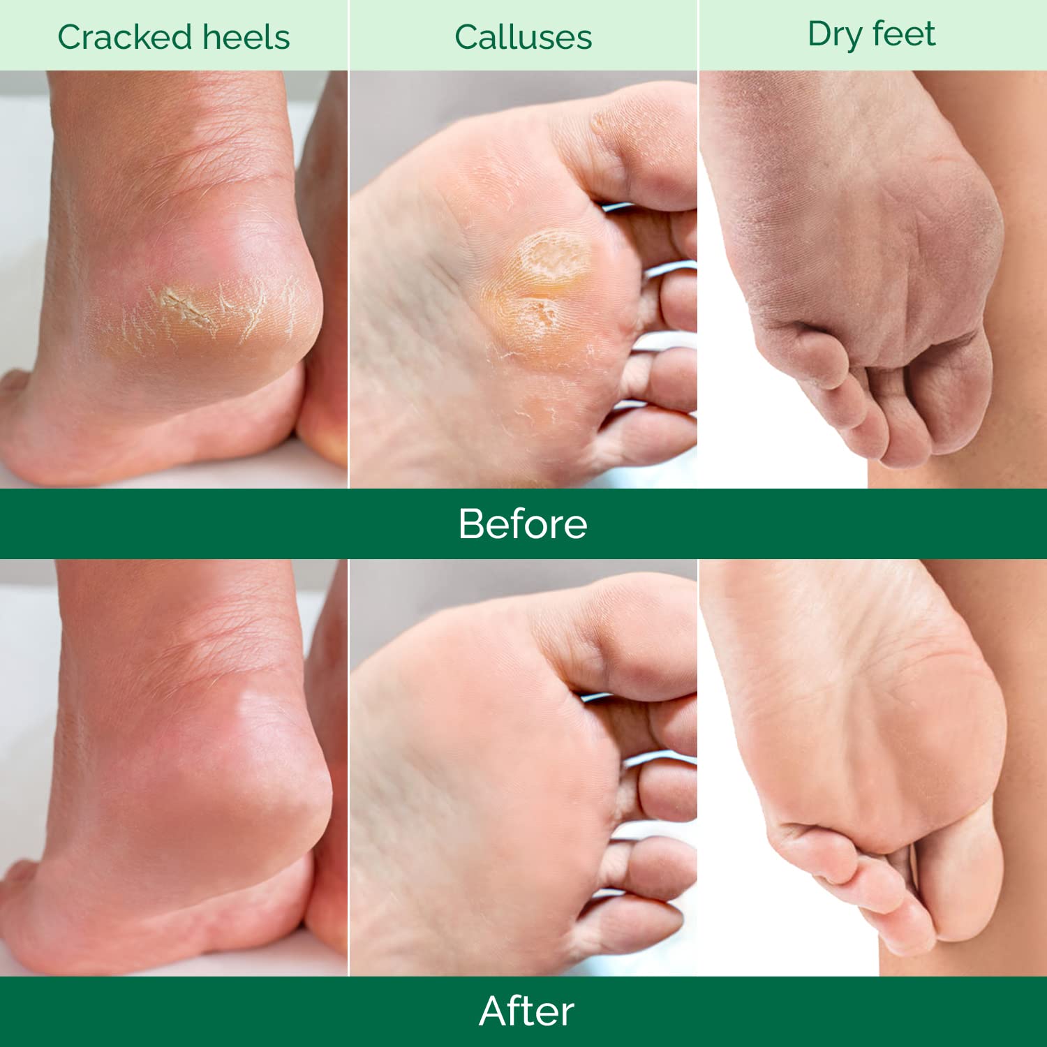 Plantifique Foot Peel Mask – 2 Pairs Exfoliating & Dermatologically Tested Foot Treatment, Removes Dead Skin & Repairs Heels for Soft Feet – Aloe Vera Scent, Gift for Men
