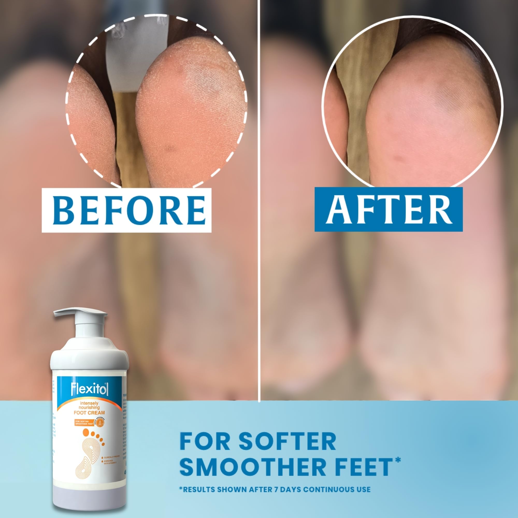 Flexitol Intensely Nourishing Foot Cream, Quick Absorbing, Vitamin E-Enriched Formula to Hydrate, Soften, and Moisturise Very Dry Feet and Legs, Maintain Smooth Feet| 1 x 485g
