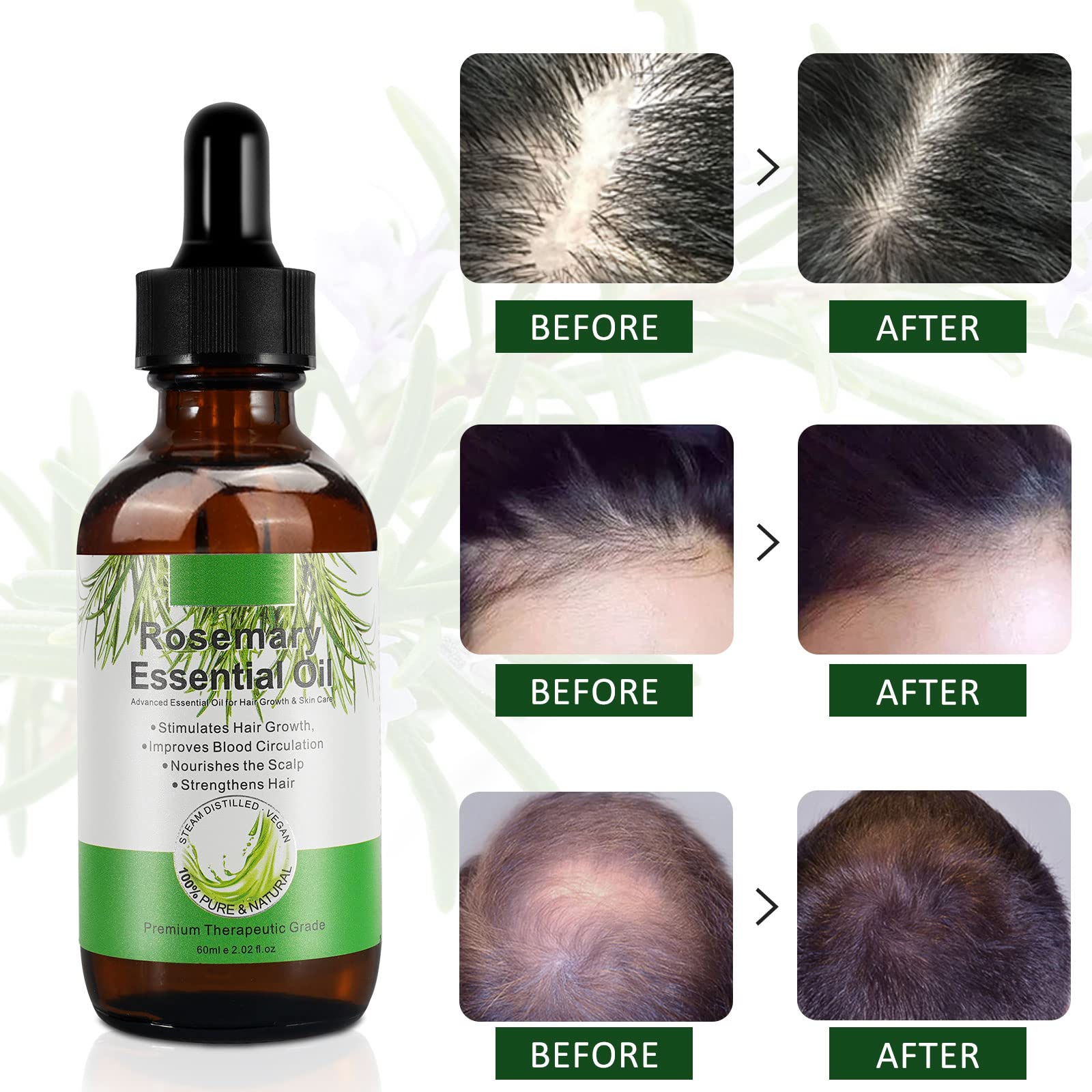 VXHDAG Rosemary Oil for Hair Growth & Skin Care - 100% Pure Rosemary Essential Oil for Eyebrow and Eyelash, Nourishes The Scalp, Stimulates Hair Growth for Men Women (2 Pack 2x60ML)