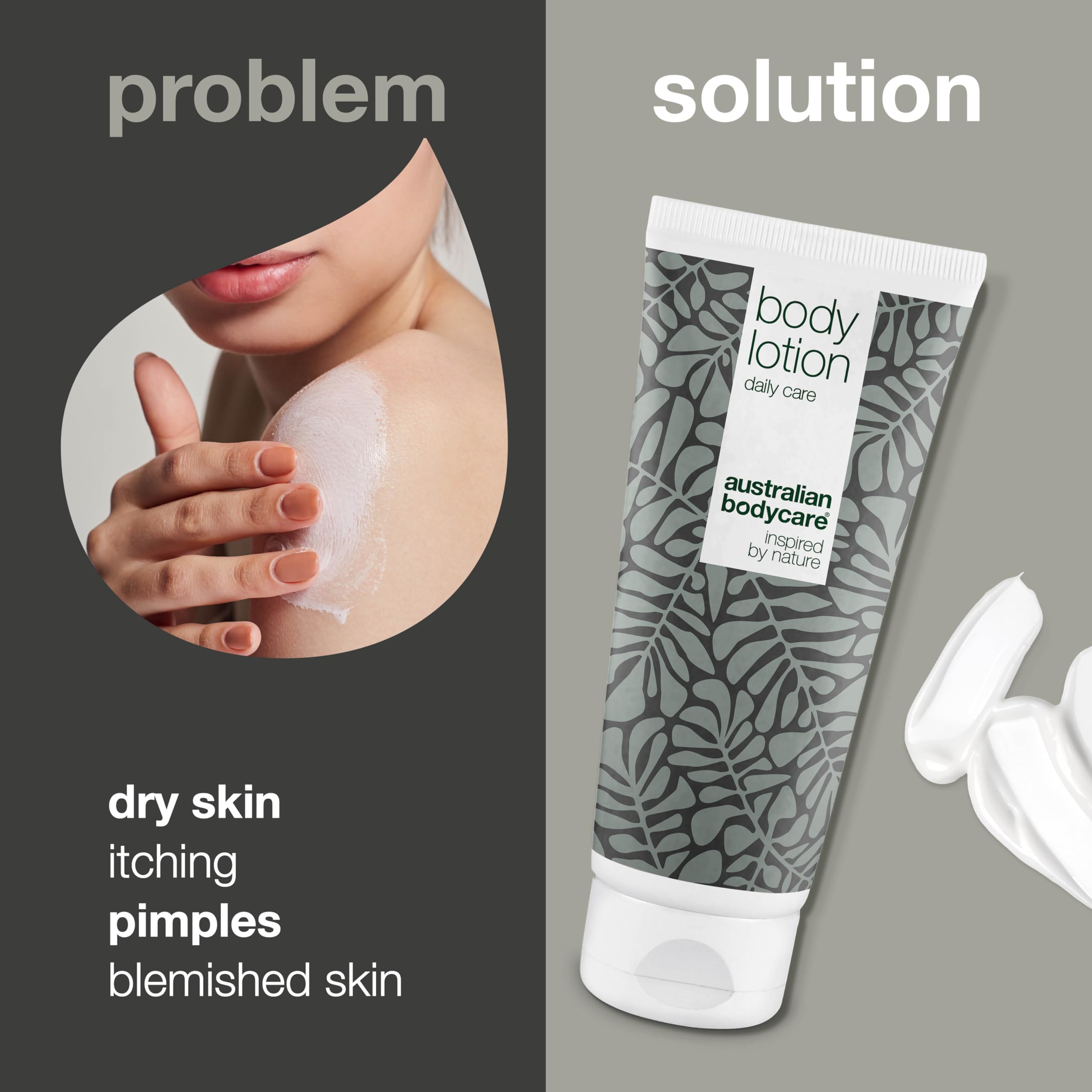 Australian Bodycare Body Lotion for Women & Men 200 ml | Tea Tree Oil Body Lotion against Dry Skin | Daily care Relieve pimples, Ringworm, Fungus, Jock Itch, Acne, Body Odor & smelly feet