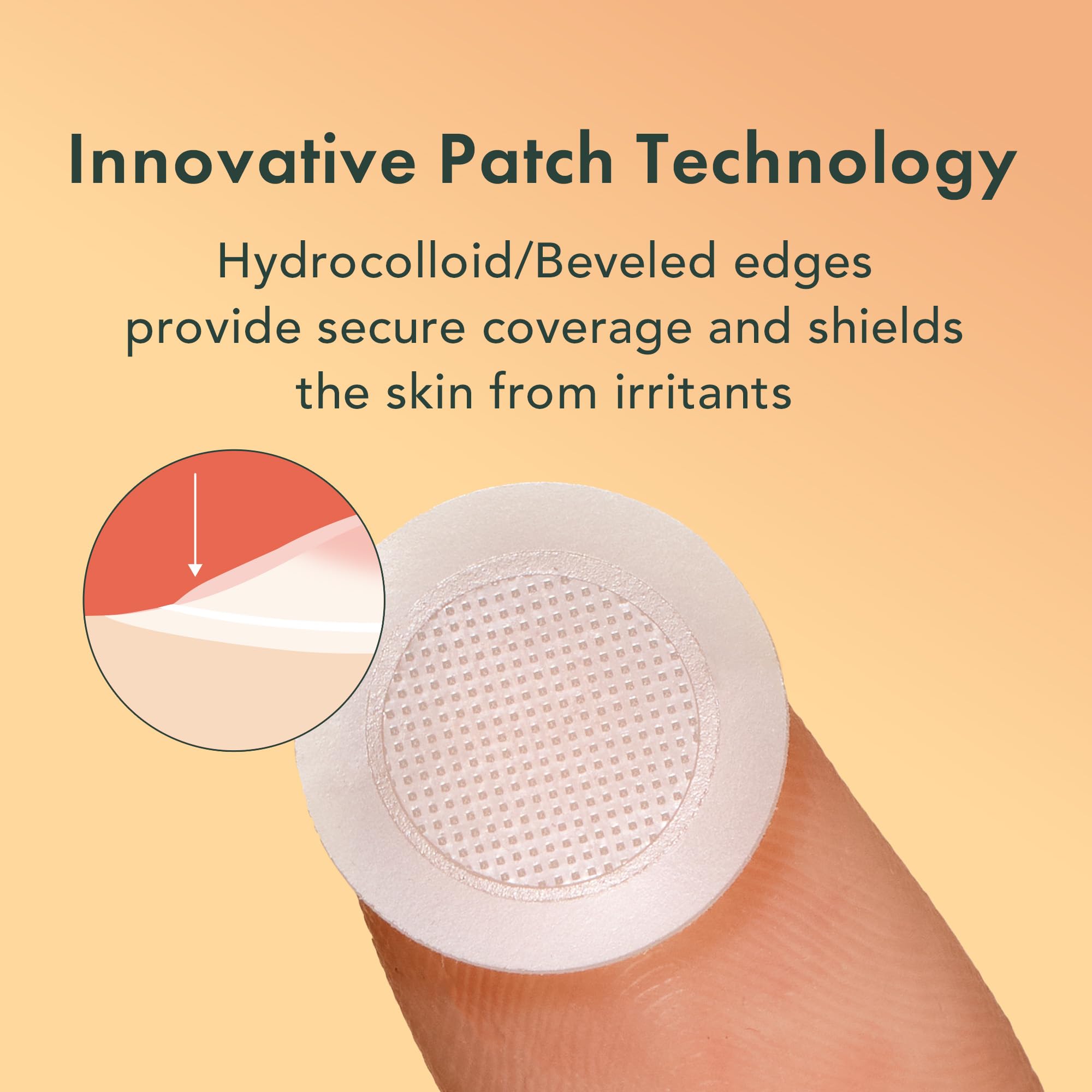 Rael Pimple Patches, Miracle Microcrystal Vitamin C Dark Spot Cover - Korean Skincare, Post Acne Mark Remover Correcting Treatment, w/ Glutathione, Niacinamide, Hydrocolloid, Vegan (9 Count)
