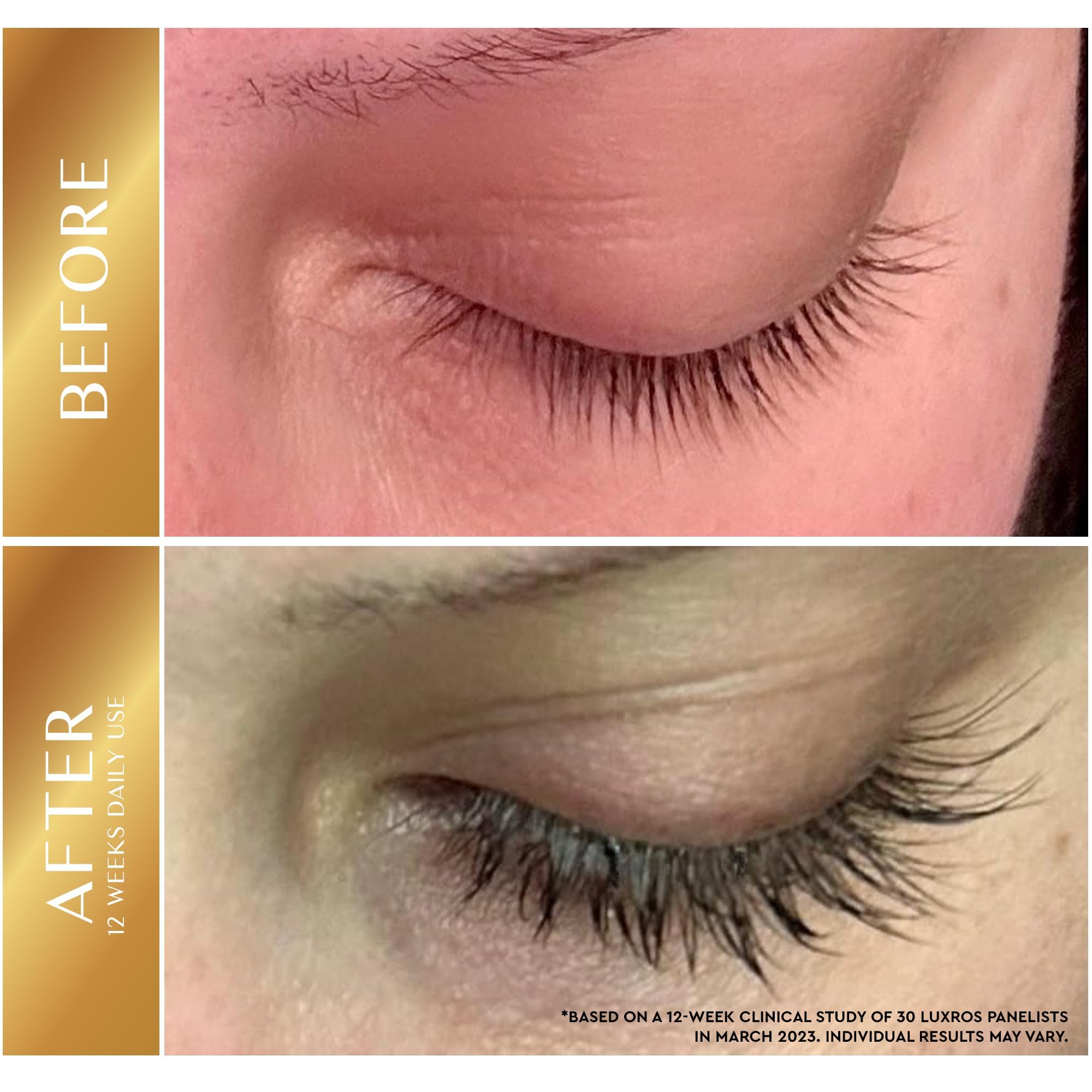 Eyelash Growth Serum 5 mL: Get Thick, Strong Lashes in Just 3-4 Weeks with Our Plant-Based Eyelash Enhancer Serum - No Parabens - Made in USA