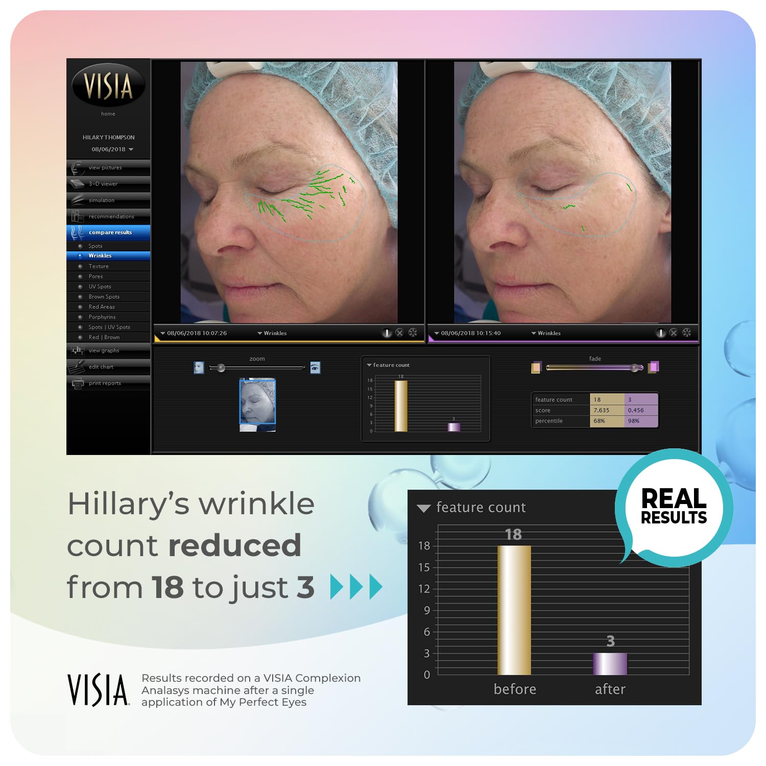 My Perfect Eyes 20ml, 200 Applications, Penny Lane, Instant Results, Clinically Proven, Anti-Ageing Serum UK Original Formula, Science-Backed Anti-Wrinkle Serum. As Seen on TV.