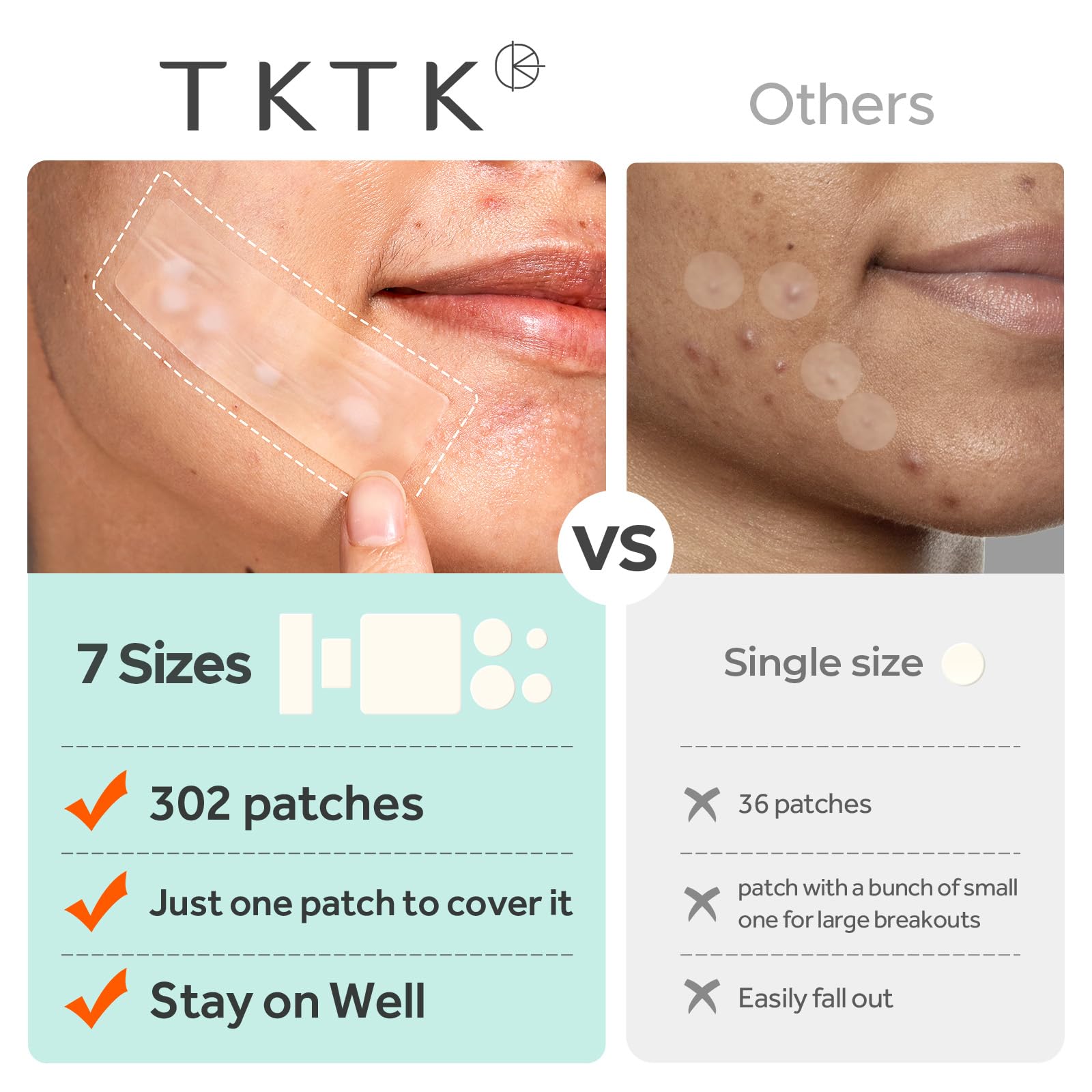 TKTK Large Pimple Patches for Face, 7 Sizes XL Acne Patches, Big Hydrocolloid Bandages for Body, Chin, Forehead, Chest, Back Zit Breakouts, Hydrocolloid Patch (7 Sizes 302 Count)