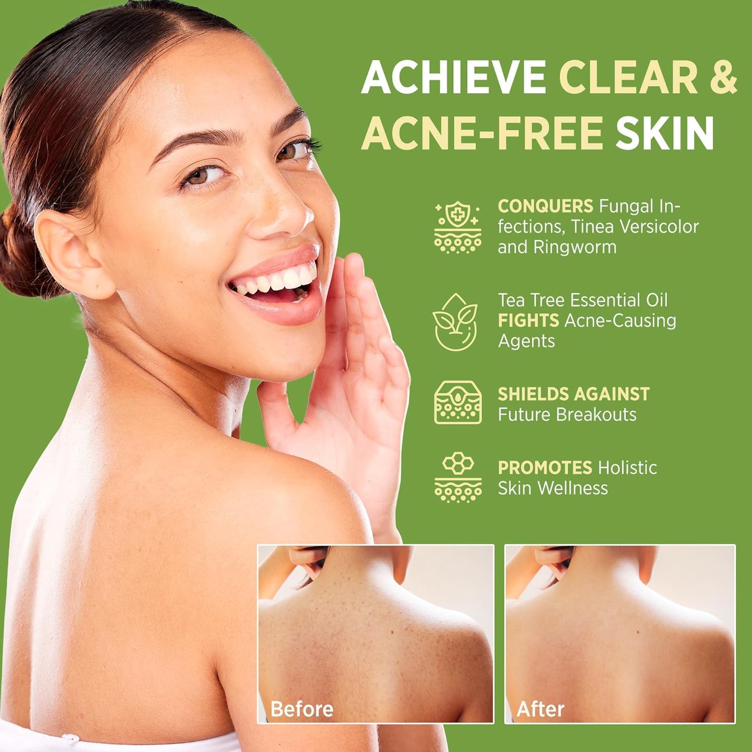 Tea Tree Oil Antifungal Soap – Antifungal Treatment for Face & Body Acne, Athlete's Foot, Tinea, Folliculitis Ringworm Jock Itch - Refresh & Cleanse with Natural Herbal Extracts