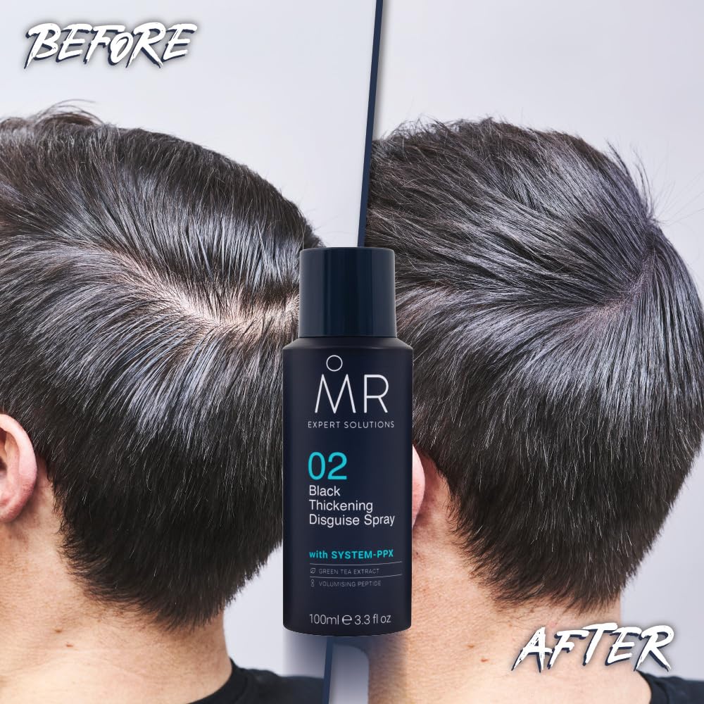 MR Dark Brown Thickening Disguise Spray for Men, Conceals Bald Patches and Thinning Hair + Protect Appearance of Thicker Hair with System PPX & Green Tea Extract, 100ml