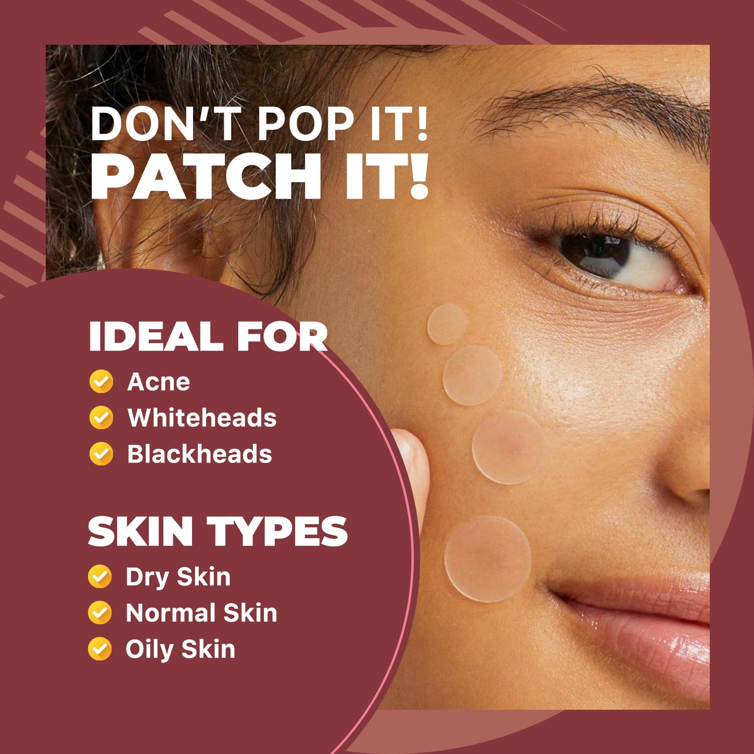 ROSELYNBOUTIQUE Pimple Patches for Face - Hydrocolloid Acne Patches For Zits Blemishes Pore Strips - Vegan Cruelty-Free Skincare Products Skin-Friendly (150 Dots)
