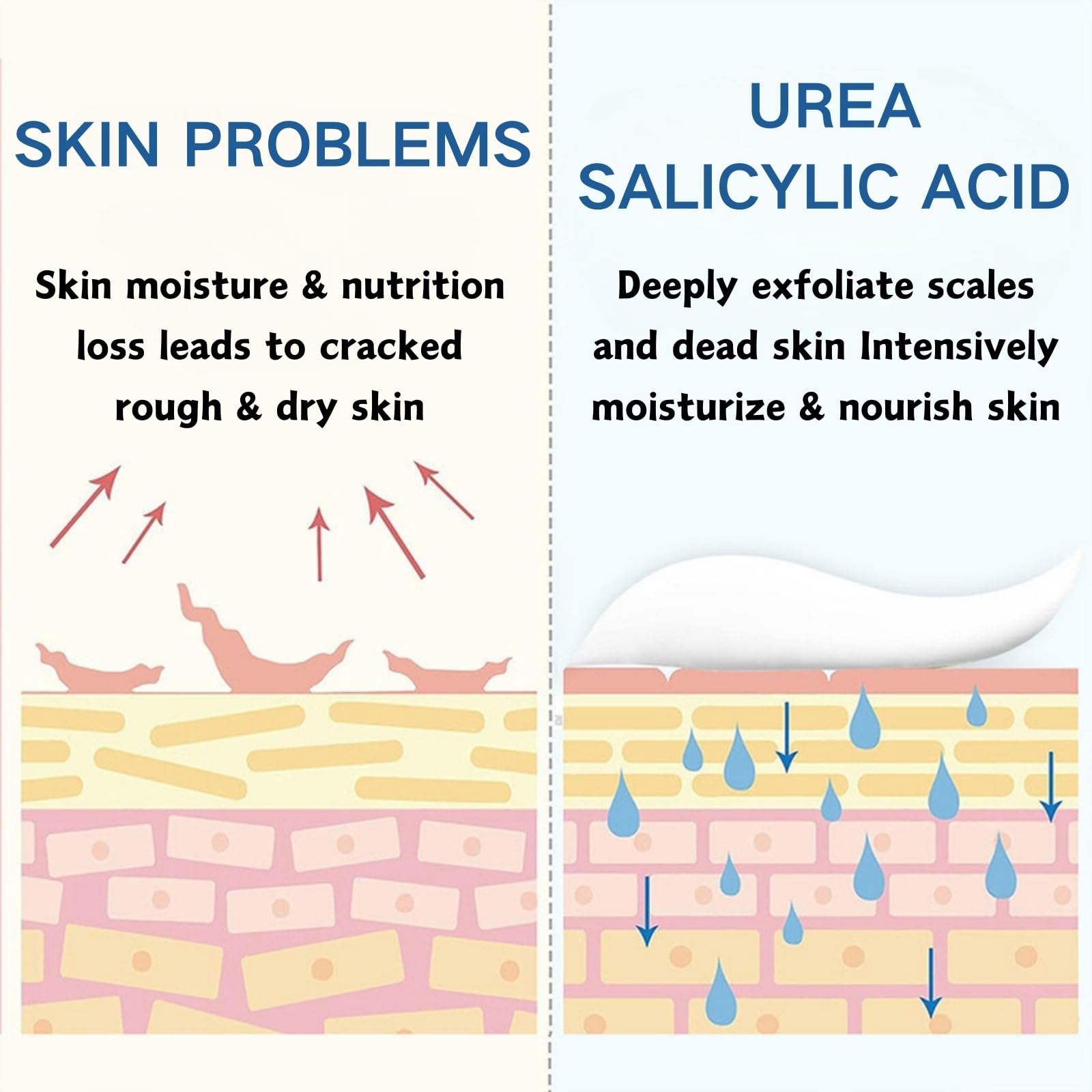 Urea Cream 60 Percent for Feet - Urea Foot Cream - Foot Cream for Cracked Heels and Dry Skin - Cracked Heel Repair Cream - Skin Care Hands & Feet - Foot Moisturiser (60% Urea Foot Creams)