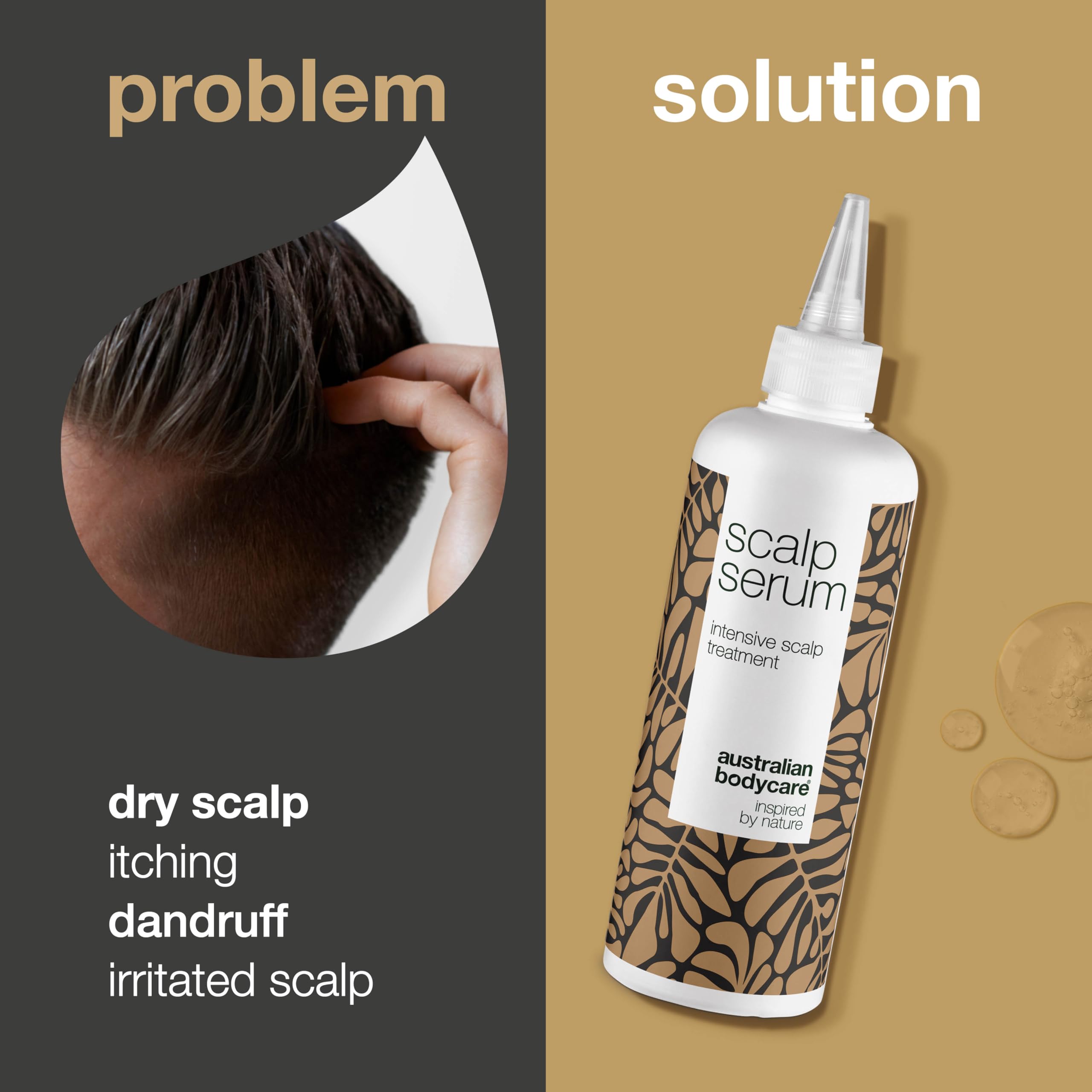 Scalp Treatment Products from Australian Bodycare for Dry, Itchy, Flaky Scalp & Hair, Dandruff, Spots & Pimples | Daily Care for People with Eczema or Psoriasis | Hair Cleanser for Men & Women (250ml)