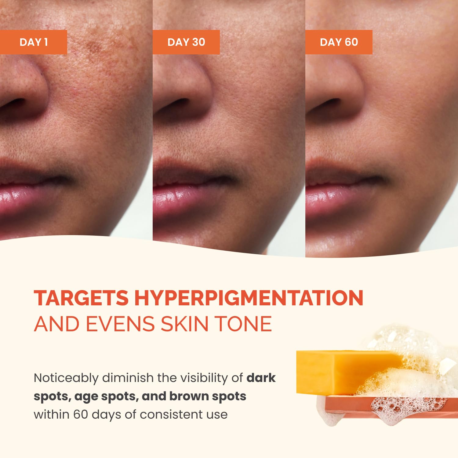 PLANTIFIQUE Kojic Acid Soap for Hyperpigmentation, Turmeric Soap 2 Bars, Hyaluronic Acid, Collagen, Vitamin C, Face Wash, 160g