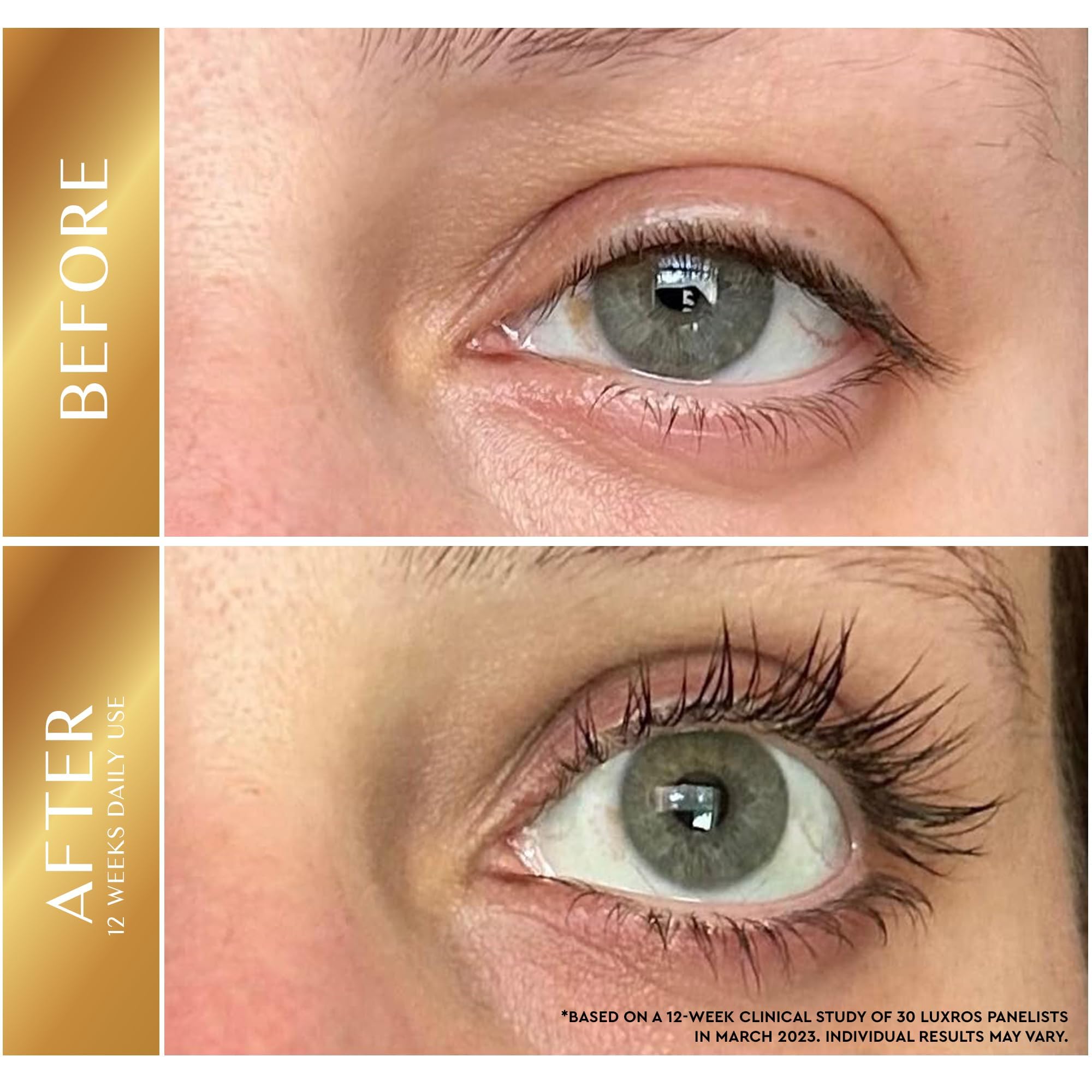Eyelash Growth Serum 5 mL: Get Thick, Strong Lashes in Just 3-4 Weeks with Our Plant-Based Eyelash Enhancer Serum - No Parabens - Made in USA