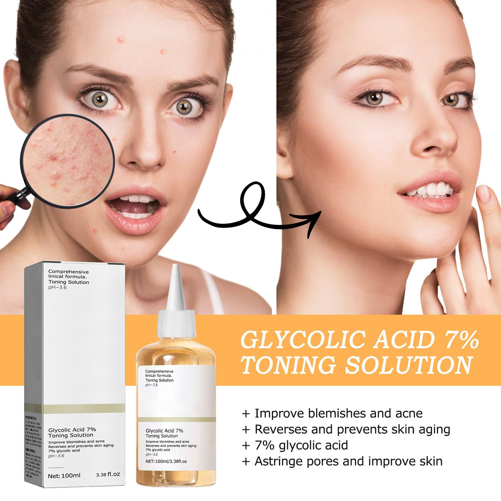 Glycolic Acid Toner, Glycolic Acid 7% Resurfacing Exfoliating Solution for Blemishes and Acne, Toner Suitable for Combination and Oily Skin, Pore Treatment (100ml) 2Pcs