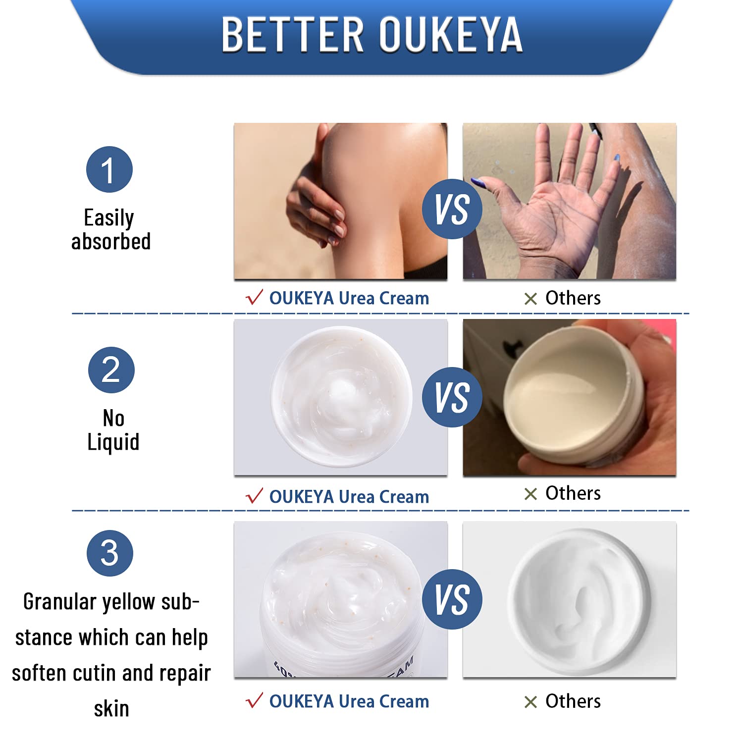 OUKEYA Urea Cream 40 Percent, Urea Foot & Hand Cream for Cracked Heels and Dry Skin, Urea Lotion for Deep Moisturizing, Callus Remover Nourishes Soften, Maximum Strength(150g (Pack of 2))