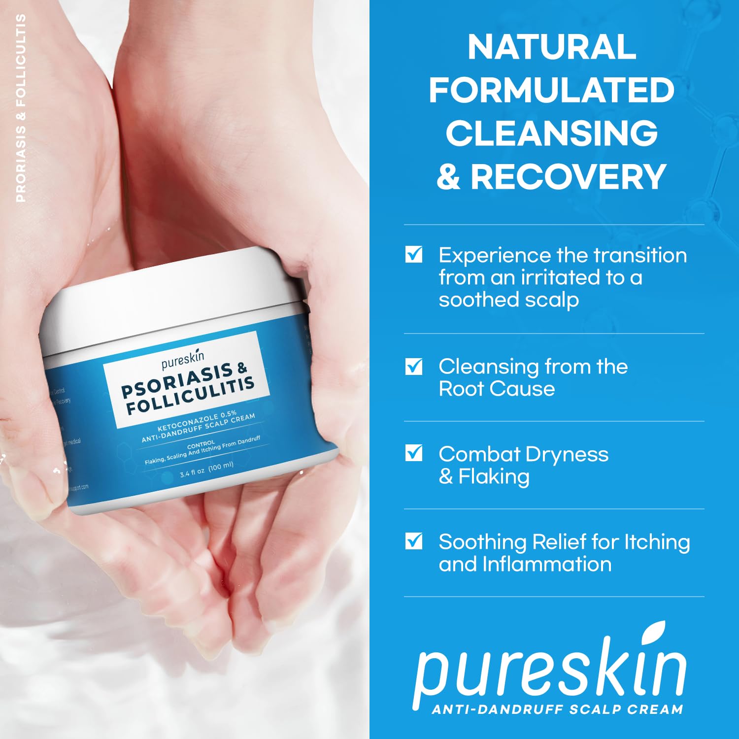PURESKIN Psoriasis Scalp Treatment Cream - Extra Strength for Scalp Psoriasis Folliculitis - Controls Itching Flaking Stubborn Dandruff 3.4 Oz