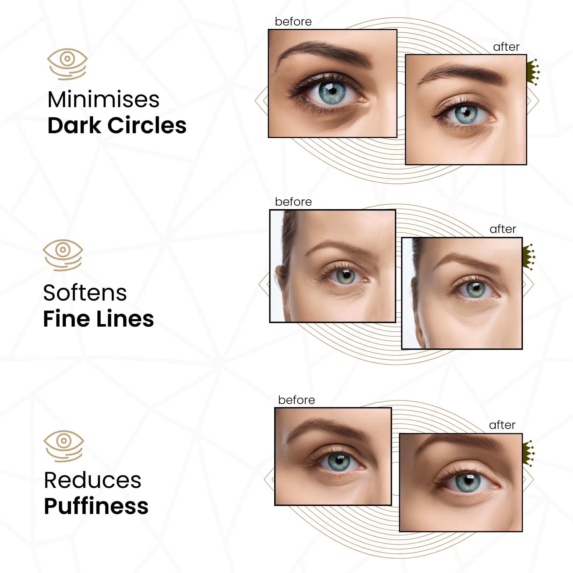 Revitale 24k Gold Under Eye Collagen Patches, Reduce Puffy Eyes & Dark Circles, Illuminate Tired Eye Masks - Firms, Brightens, Energises (Jar - 30 Pair)