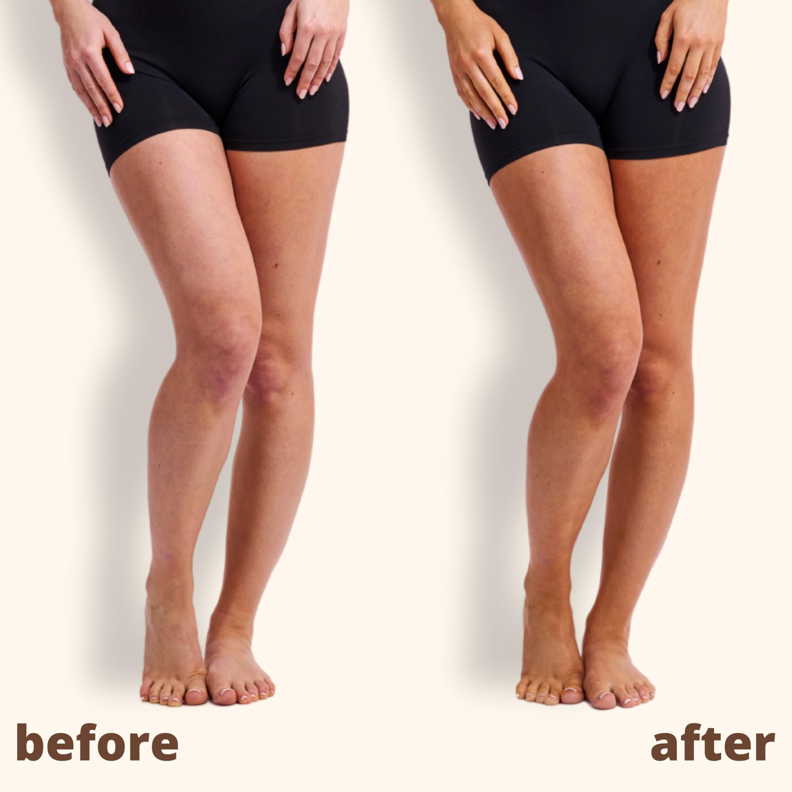 Skinny Tan Tan & Tone Self Tan Oil - Streak Free Natural Looking Fake Tan with Coconut Oil, Enriched with Guarana Extract to Tone & Firm Skin, Cruelty-Free & Vegan - Medium, 145ml