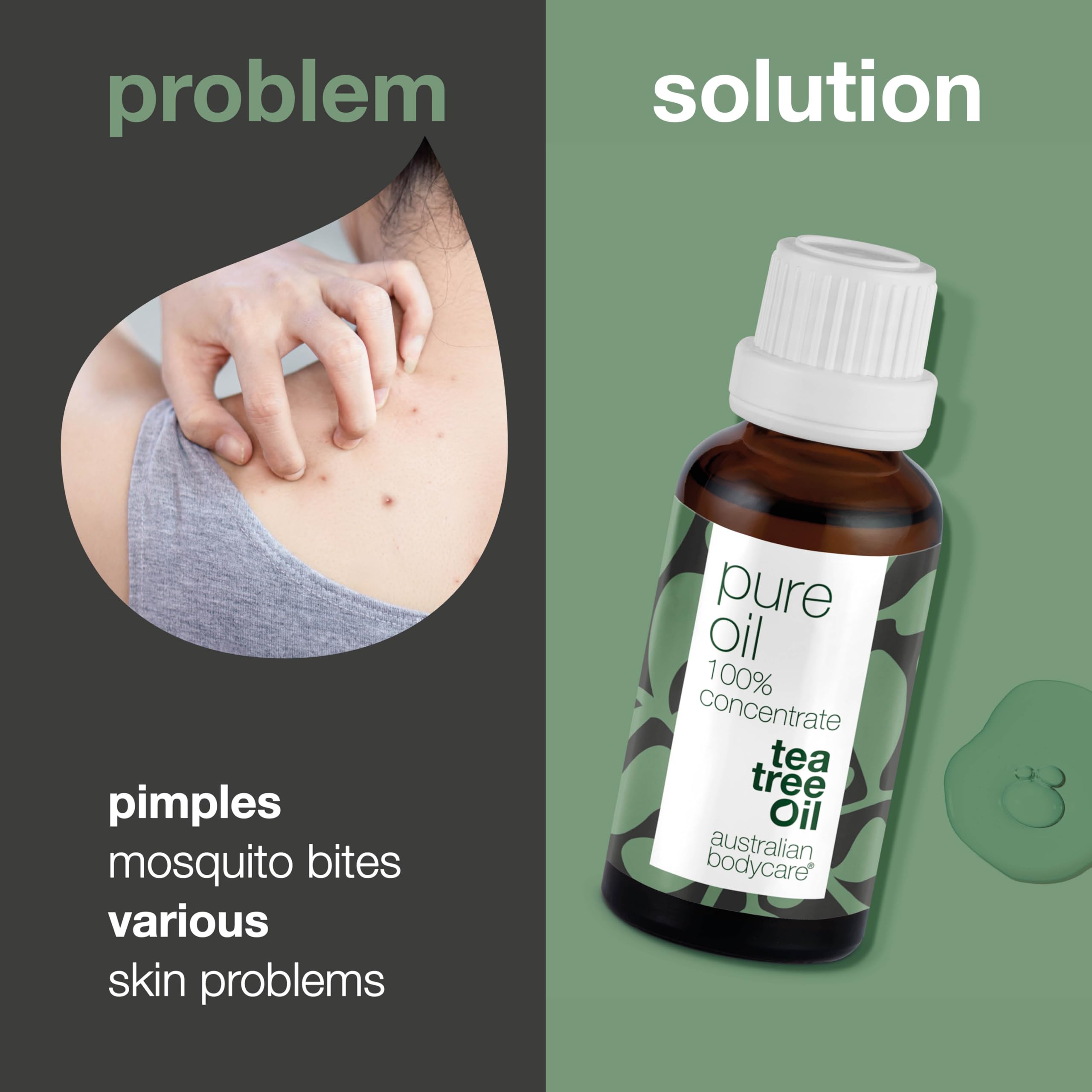 Australian Bodycare 100% Pure Tea Tree Oil, 30 ml | Our Tea Tree Oil is Pure and of Pharmaceutical Grade