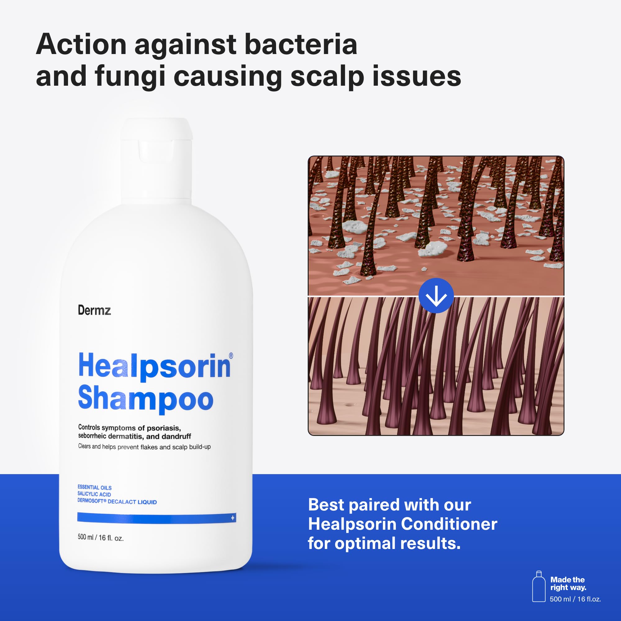 Healpsorin Psoriasis Anti Dandruff Shampoo. Flaky Scalp Psoriasis Treatment. Helps with Eczema, Dermatitis & Itchy Dry Scalp. Salicylic Acid Shampoo. Contains Dermosoft® 1%. 500ml
