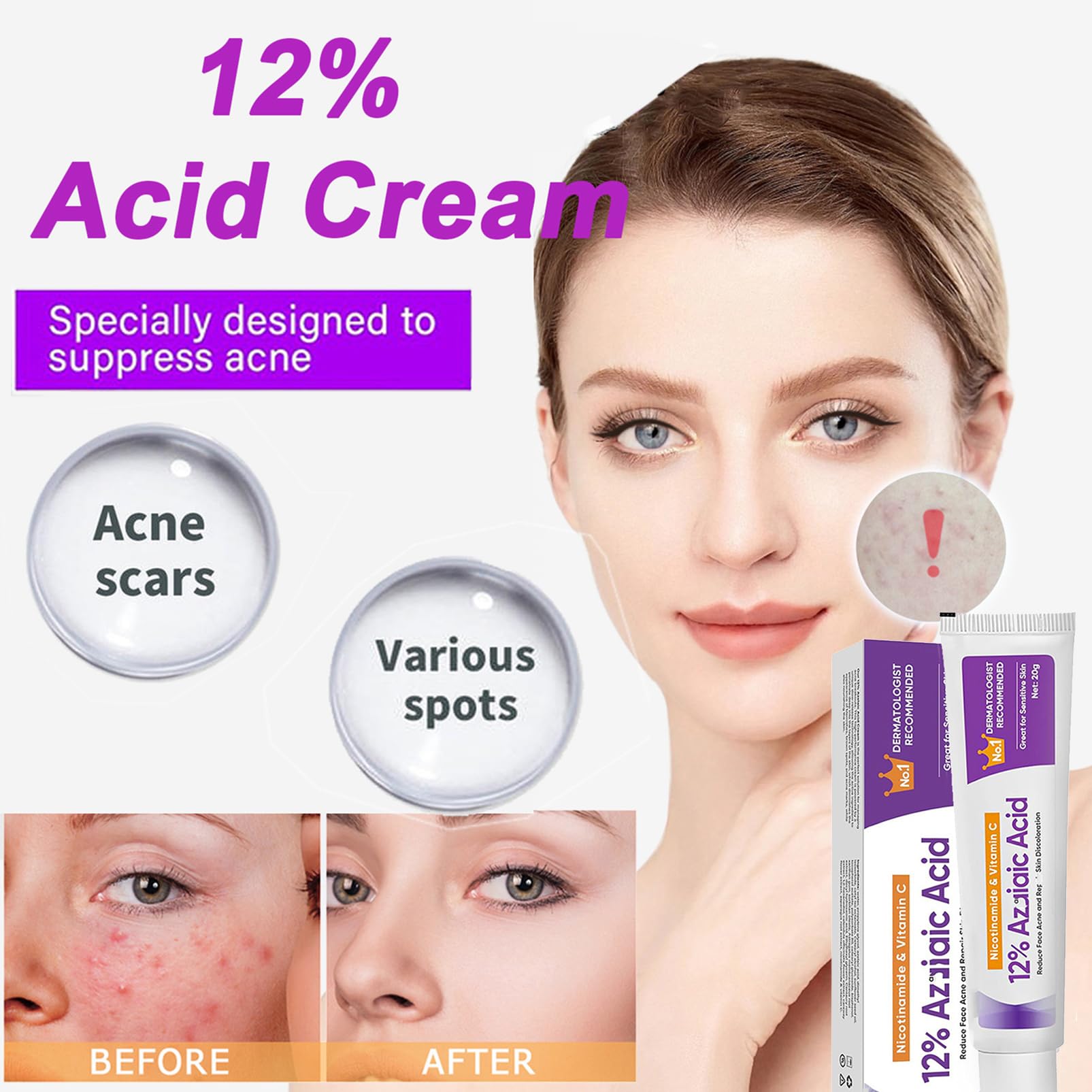 (2PCS) Acid Face Cream, Acid 12% Facial Serum Cream, Niacinamide & Vitamin C for Redness Face, Dark Spot, Rosacea,Acne,Face Skin Care Beauty Products,Skincare for All Skin Types 20G (2)