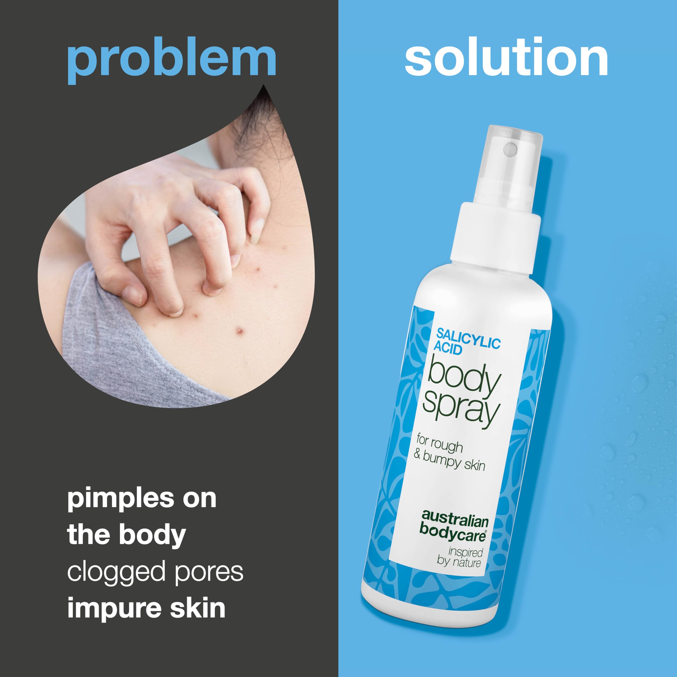 Salicylic acid spray against body breakouts, clogged pores and rough skin – with 2% salicylic acid and glycolic acid for clearer, smoother skin