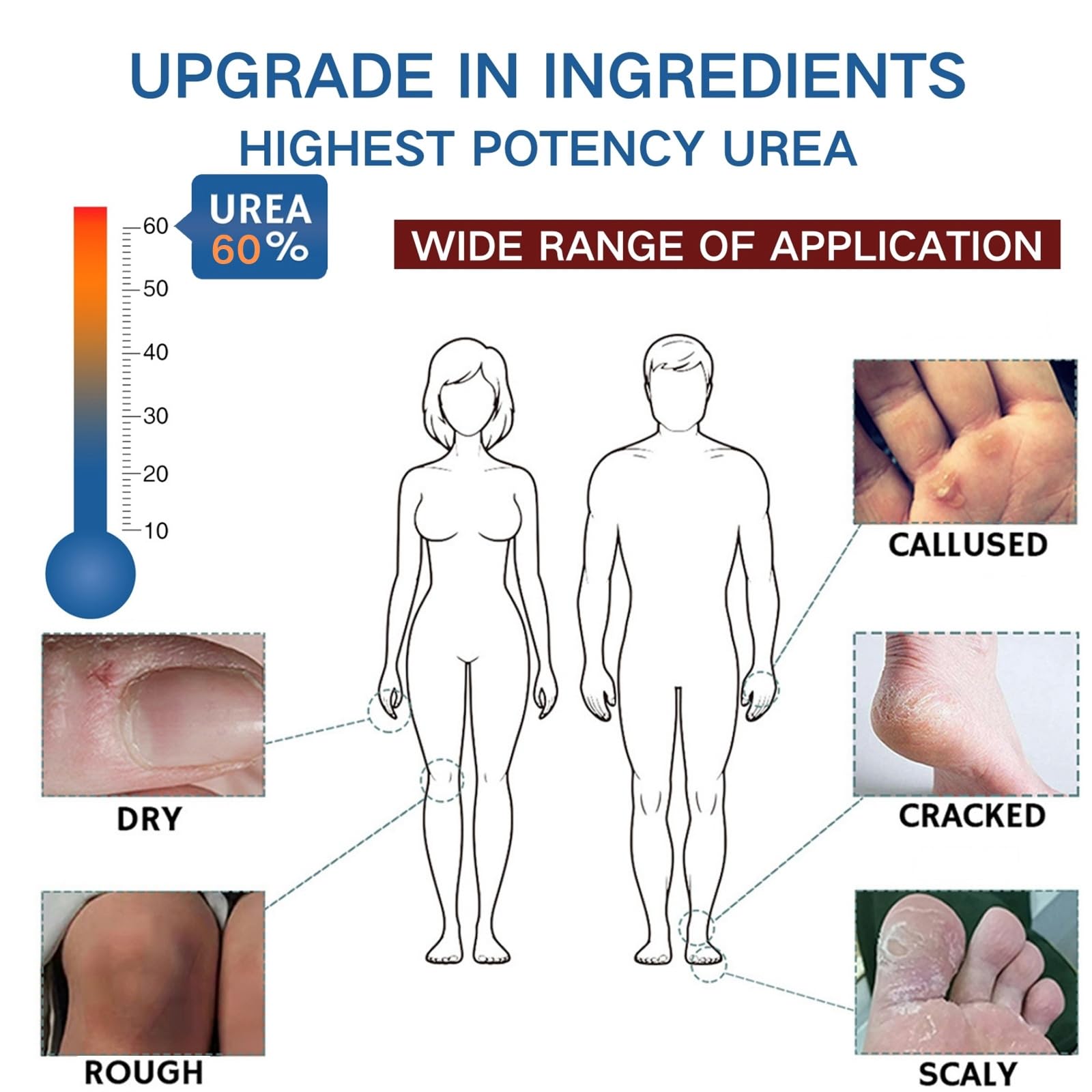Urea Cream 60 Percent for Feet,4PCS Urea Foot Cream Upgrade Set with 2PCS 60% Urea Foot Cream,1Pairs Moisturizing Socks and 1 Foot File,Cracked Heel Repair Cream,Cracked Heels and Dry Skin